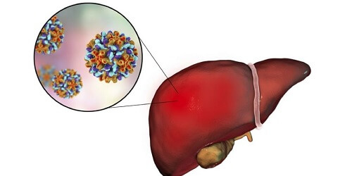 Hepatitis B