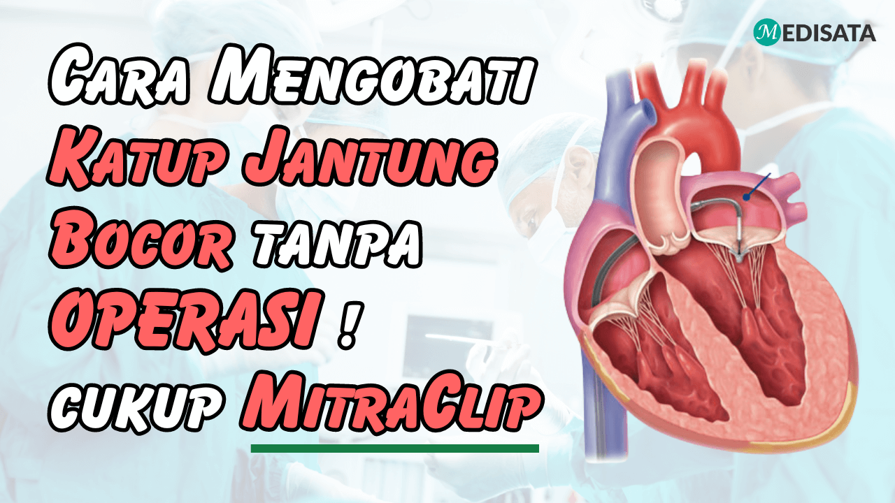 MitraClip
